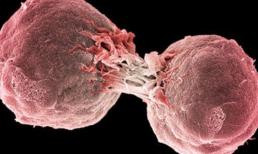 Có bệnh trong người, đại tiện là 'tiên tri', nếu thấy 3 'vật' trong lúc đại tiện, đó có thể là tế bào ung thư đang 'phóng thích'