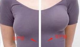 Tại sao phụ nữ dễ bị chảy xệ ngực?