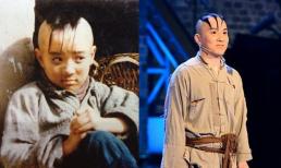 Cậu bé 'Tam Mao' đã trưởng thành, nhiều năm bị thương da đầu đến không thể mọc tóc, sau 25 năm vẫn độc thân