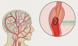 40 tuổi là bước ngoặt của sức khỏe, 8 'từ khóa' cần ghi nhớ sau tuổi này