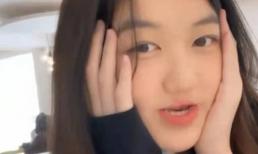 Con gái Vương Phi vẫn không giấu được dấu vết của bệnh hở hàm ếch dù trải qua nhiều ca phẫu thuật chỉnh hình