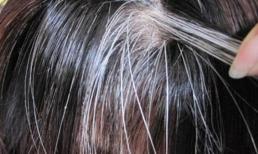 Bác sĩ gan mật: Hai sợi tóc trên đầu chuyển sang màu trắng có thể là dấu hiệu của tổn thương gan, cần đi kiểm tra càng sớm càng tốt
