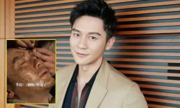 Lý Thần bị thương nặng ở mắt khi đang đóng phim bom tấn có kinh phí hơn 4,5 nghìn tỷ đồng