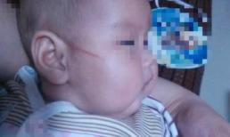 Trẻ sơ sinh rất thích gãi thậm chí là cào mặt, tại sao lại 'bạo lực' như vậy? Hóa ra có rất nhiều vấn đề 