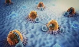 Bác sĩ: Sau khi xuất hiện 4 loại viêm này, cần phải điều trị kịp thời để tránh phát triển thành 'ung thư'