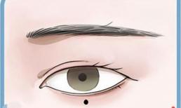 Nốt ruồi quanh mắt có ý nghĩa gì? Tốt hay xấu chủ yếu phụ thuộc vào màu sắc!  