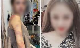 Bị tố bạo hành vợ xuyên đêm ở Yên Bái, người chồng lên tiếng: Có tát, đấm vào đầu, vai nhưng không đánh, nhốt