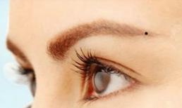 Nốt ruồi ở những vị trí này là nơi dễ kiếm tiền nhất, và đều ẩn chứa những điều bí ẩn