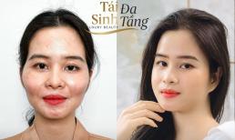 Đừng đầu tư vào Tái sinh đa tầng - Nếu bạn không muốn trẻ ra 10 tuổi 