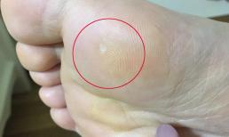 Có bệnh trong cơ thể, tiên tri chân! Nếu bàn chân phát ra 3 dấu hiệu 'bất thường' này, cần chú ý kiểm tra kịp thời