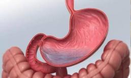 80% ung thư dạ dày có thể phòng ngừa được ở giai đoạn đầu! Bạn có biết 4 dấu hiệu chính của bệnh ung thư dạ dày trước khi nó đến không?