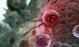 Nói trắng ra: Nếu trên cổ có 3 “dấu hiệu này” thì có thể là tế bào ung thư muốn “phóng sinh”, nên cố gắng đừng bỏ qua