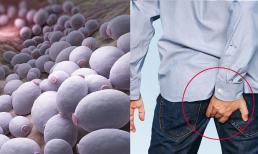 Vùng xung quanh hậu môn thường xuyên ẩm ướt và ngứa ngáy, phải làm sao để khắc phục nhanh chóng? 4 gợi ý bạn nên chú ý