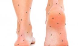 3 tình trạng này ở bàn chân chứng tỏ lượng đường trong máu của bạn đã vượt quá tiêu chuẩn, hãy kiểm soát đường huyết kịp thời