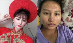 Cô gái xinh đẹp xuống sắc thảm hại khi mang bầu và cách đối xử của chồng gây chú ý