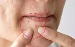 Tử cung có tốt hay không, bạn có thể nhận biết bằng cách nhìn vào khuôn mặt! 5 tình huống này xuất hiện trên mặt chứng tỏ 'ở dưới' rất bẩn!!! 