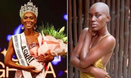 Người đẹp 'đầu trọc' đăng quang Hoa hậu Hoàn vũ Ghana 2022