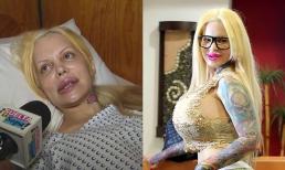 Nữ diễn viên 45 tuổi người Argentina đã phẫu thuật thẩm mỹ 53 lần khiến khuôn mặt bị liệt, giờ cô cảm thấy mình quá ngu ngốc