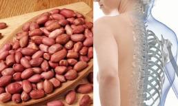 Đậu phộng có phải là chất tăng tốc cho bệnh loãng xương không? Bác sĩ: Nếu không muốn xương trở thành 'tổ ong', hãy ăn bớt 2 loại rau