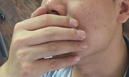 Trước khi ung thư miệng xuất hiện, bạn có thể có mùi này trong miệng! Làm thế nào để ngăn ngừa ung thư miệng?