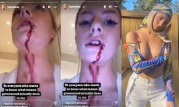 Bạn gái chân dài của siêu sao Manchester United đăng video bị bạo hành với gương mặt bê bết máu, toàn thân đầy vết bầm tím