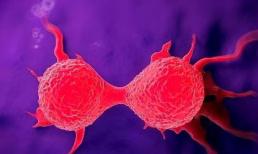 Lời khuyên của bác sĩ: ăn 3 loại trái cây càng ít càng tốt, nếu không có thể khiến tế bào ung thư ngày càng 'bén rễ vào cơ thể'