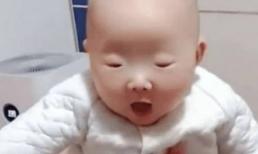 Con 6 ngày sau khi sinh không mở mắt, bố mẹ vội vàng đưa bé đi khám nhưng bác sĩ đã bật cười khi nhìn thấy kết quả 