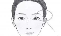 5 nốt ruồi may mắn nhất trên mặt! Nhìn xem bạn có bao nhiêu cái?