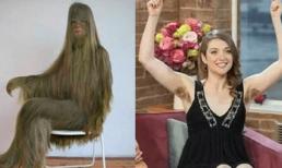 Người phụ nữ có bộ lông dài nhất trong lịch sử, sau khi loại bỏ hết lông trên cơ thể, cô ấy 'lột xác' thật tuyệt vời