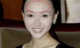 Người phụ nữ có sọc trên trán có tính khí xấu và tính cách kiêu hãnh, dễ khiến đàn ông nản lòng!