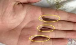 Khi ghép các ngón tay lại với nhau thì có bao nhiêu lỗ? Hóa ra nó có thể phản ánh cả tính cách và mức độ giàu có của bạn