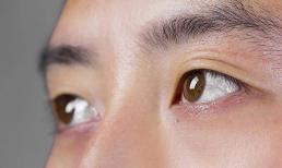 Lòng trắng của mắt có màu vàng, có phải bạn bị viêm gan không? Bác sĩ: Có 3 loại khó chịu ở mắt, hãy kiểm tra gan càng sớm càng tốt