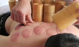 Giác hơi có thể giải độc không? Vết đỏ trên da sau khi giác hơi là gì?