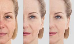 6 yếu tố phá hủy collagen trong da, bảo sao đã làm đủ mọi cách mà da vẫn nhăn nheo, chảy sệ