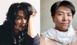 Diễn viên 'Ông trùm' Quang Sơn bị ung thư tuyến giáp