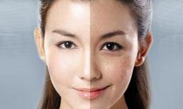 Đối với những người có hắc tố da, nên ăn nhiều hơn 4 loại thực phẩm hoặc có thể làm mờ vết nám và cải thiện làn da