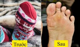 Điều gì có thể xảy ra với sức khỏe của bạn nếu đi tất lúc ngủ?