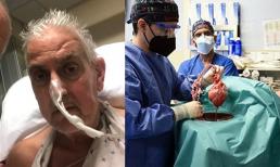 Bệnh nhân ghép tim lợn đầu tiên trên thế giới qua đời sau hai tháng phẫu thuật