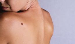 Những người có 4 nốt ruồi này tiền tài kém, cả đời buôn ba vất vả