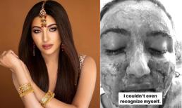 Sốc với gương mặt bị bỏng trong quá khứ của Á hậu 1 Miss World 2021