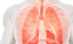 Phổi có tốt hay không, nhìn bàn tay để nhận biết! Có 4 biểu hiện bất thường trên bàn tay, hãy chú ý đến phổi nhiều hơn