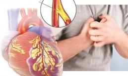 Nhạc sĩ Ngọc Châu đột ngột qua đời ở tuổi 55: Bệnh suy tim nguy hiểm như thế nào?