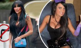 Mẫu nữ nổi tiếng Úc gây sốc với nhan sắc biến dạng do phẫu thuật thẩm mỹ