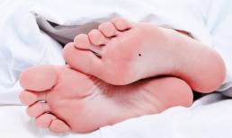 Những vị trí nốt ruồi ở bàn chân đem lại may mắn, tài lộc phú quý, tiền tài và danh vọng đều có đủ, hậu vận viên mãn