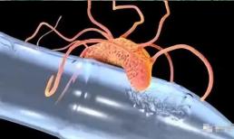 Các nhà khoa học lần đầu tiên tìm thấy các hạt vi nhựa trong máu người, có thể di chuyển khắp cơ thể