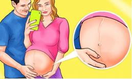 Giải mã đường sọc nâu mẹ bầu nào cũng có trên bụng khi mang thai. Đường này xuất hiện có ảnh hưởng đến thai kỳ của mẹ không?