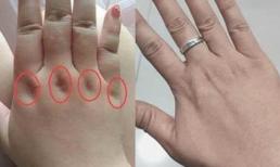 Mu bàn tay duỗi ra một cách tự nhiên, gốc ngón trũng hay bằng phẳng là tùy vào kiếp này bạn có giàu sang hay không!