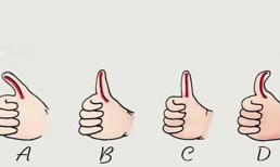 Hình dáng và số phận bàn tay như thế nào phụ thuộc vào việc bạn giàu hay nghèo trong những năm tháng sau này