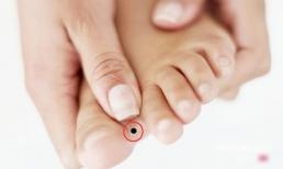 4 vị trí nốt ruồi ở chân là điềm báo mang đến may mắn, ai sở hữu dễ giàu sang, cuộc sống ngập trong vinh hoa phú quý