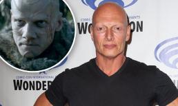 Sao nam 'Trò chơi vương quyền' bị bắt vì dính cáo buộc quan hệ với trẻ vị thành niên